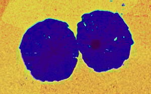 Nanoindentation mapping of nodular cast iron structure, showing the usage of a hardness map obtained by nanoindentation a microscope.